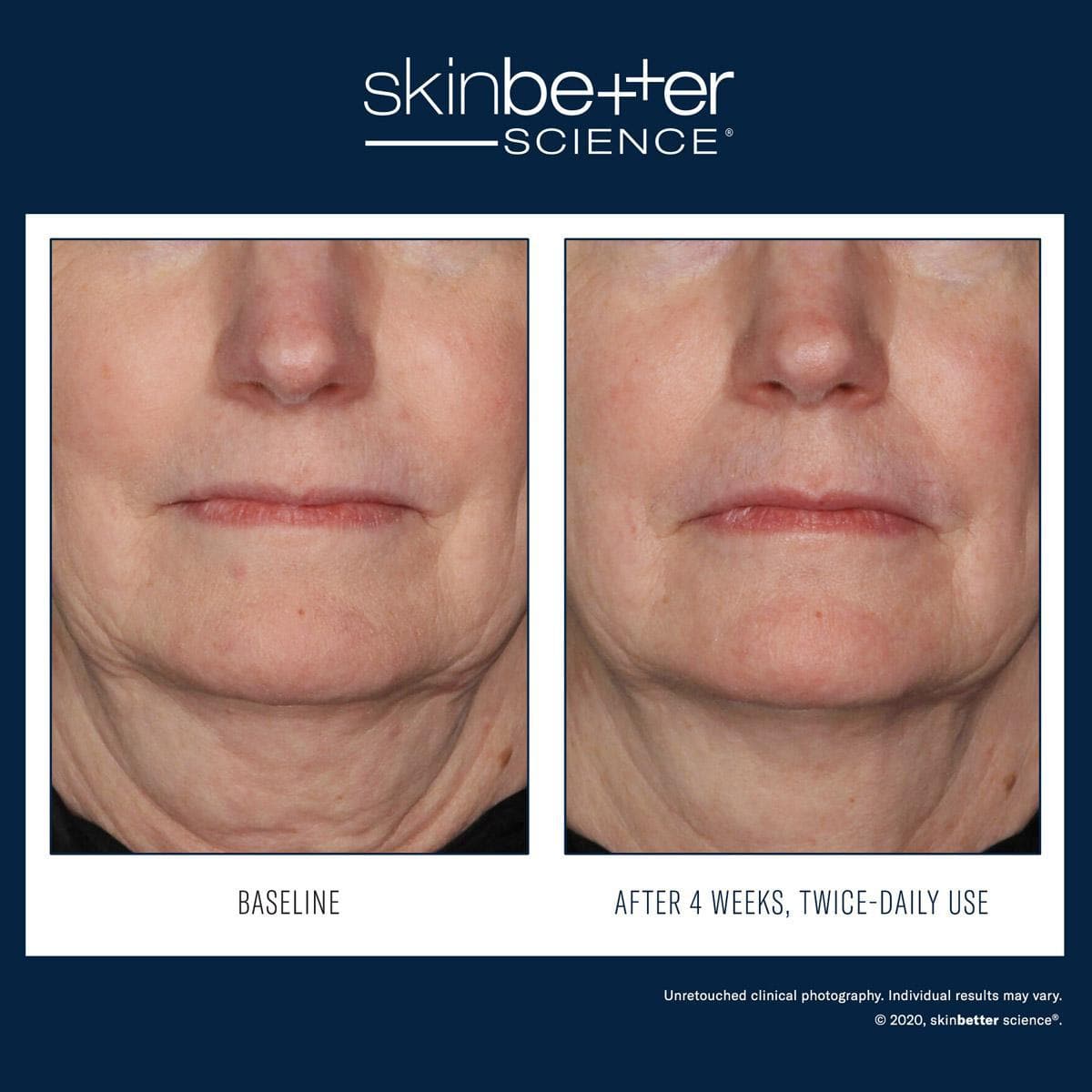 Skinbetter Science - Interfuse Treatment Cream Face & Neck by Monarch MD Medical Aesthetics