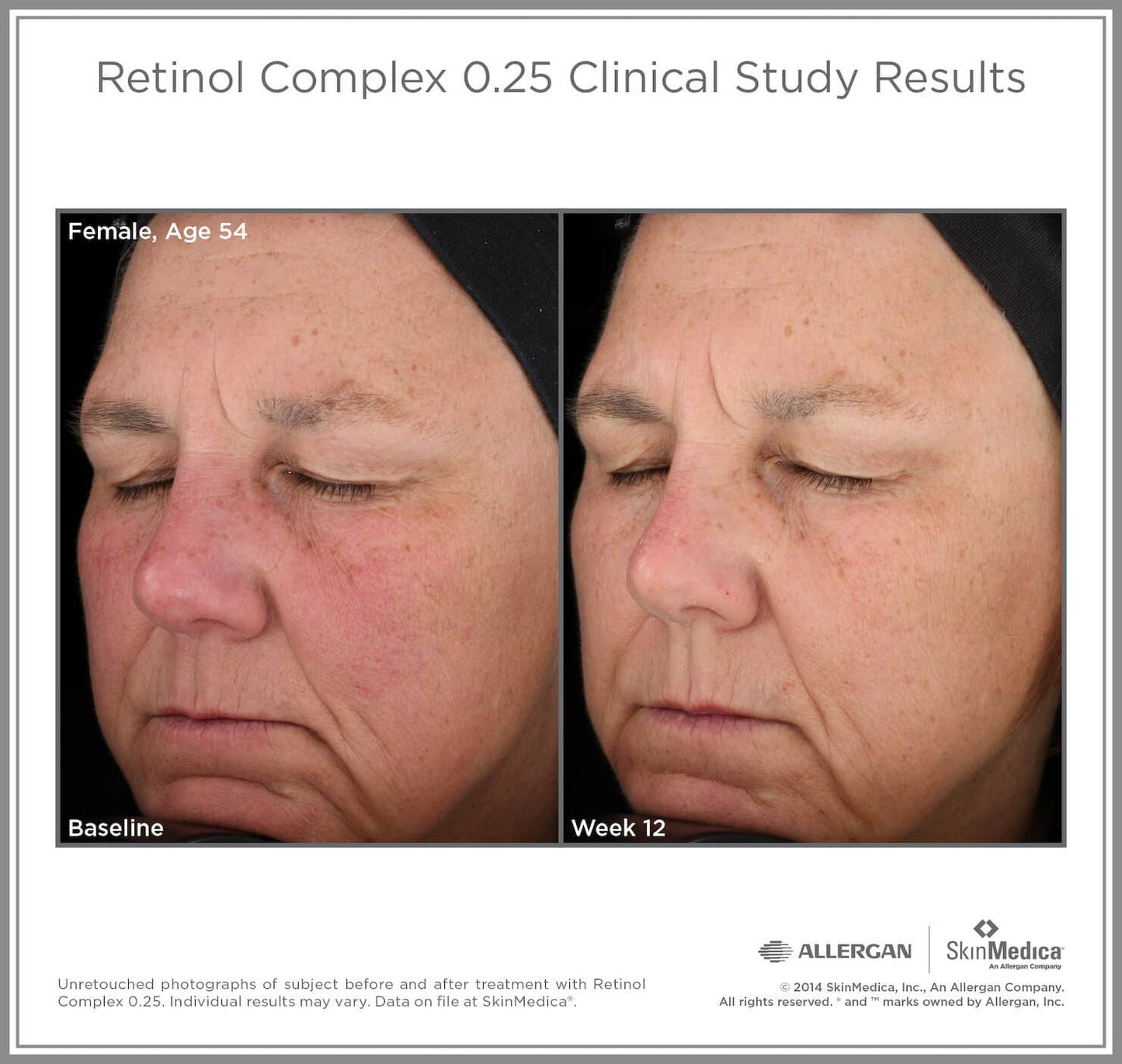 SkinMedica Retinol Complex by Monarch MD Medical Aesthetics