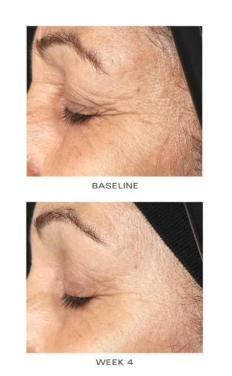 ZO Growth Factor Serum by Monarch MD Medical Aesthetics