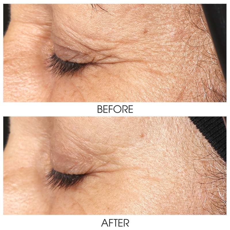 ZO Growth Factor Serum Eye by Monarch MD Medical Aesthetics