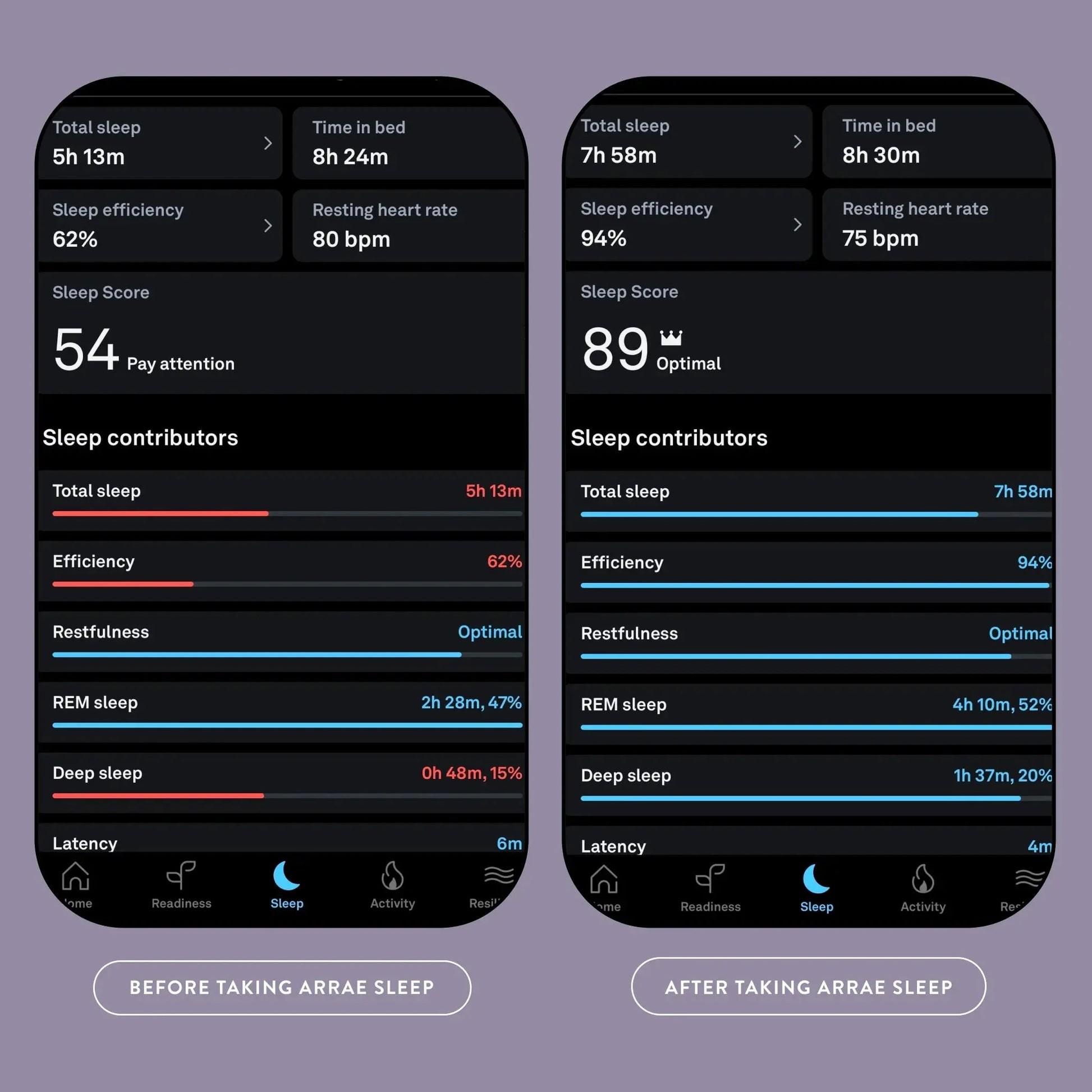 Arrae - Sleep by Monarch MD Medical Aesthetics