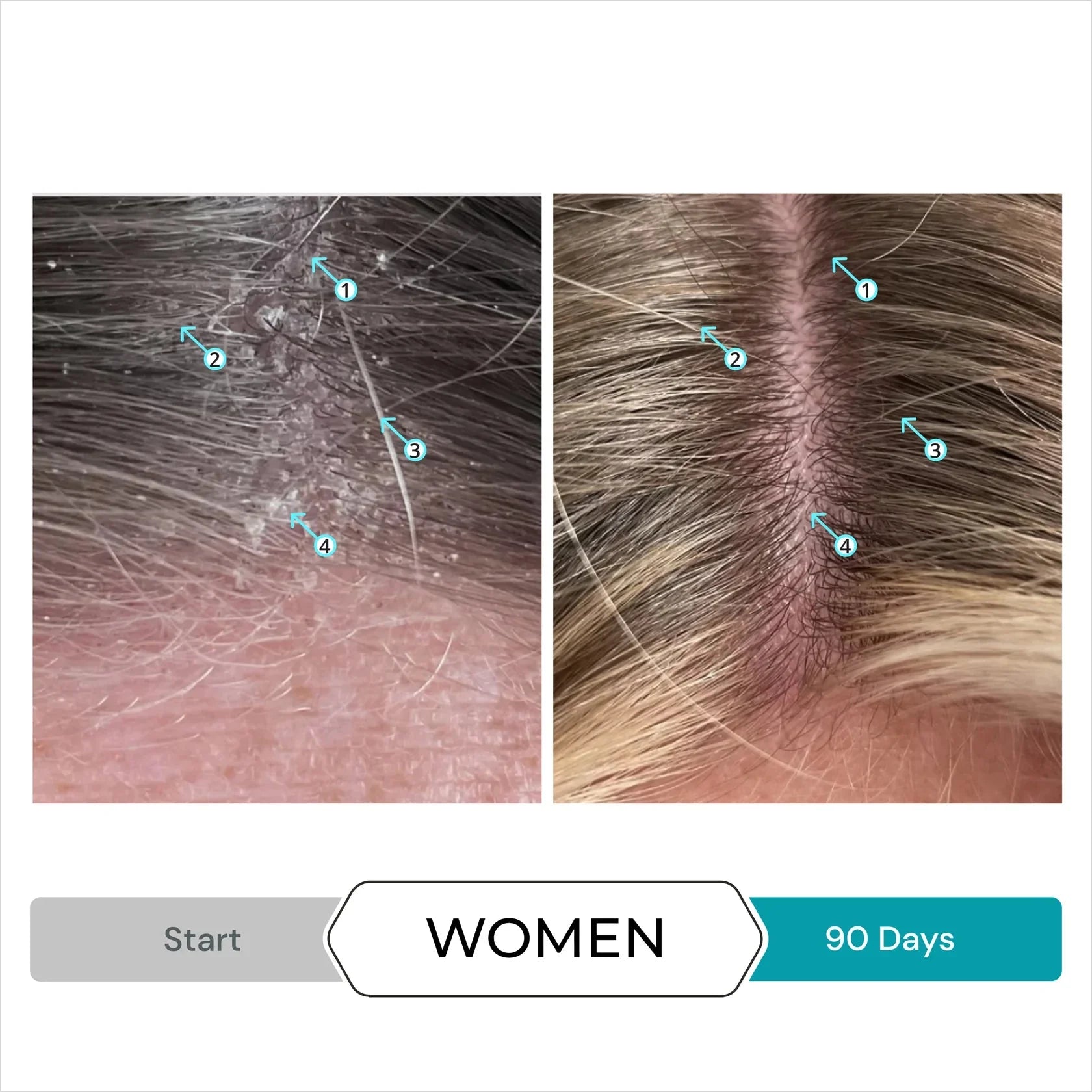 Dandrene Anti-Dandruff Conditioner by Monarch MD Medical Aesthetics