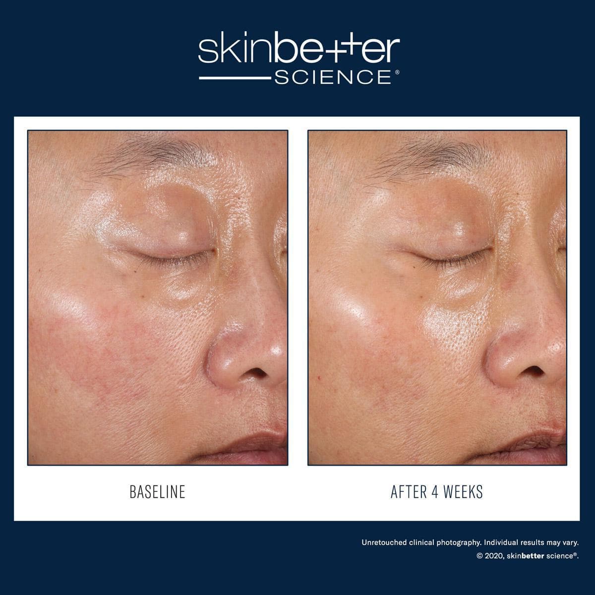 SkinBetter Science - A-Team Duo Kit by Monarch MD Medical Aesthetics