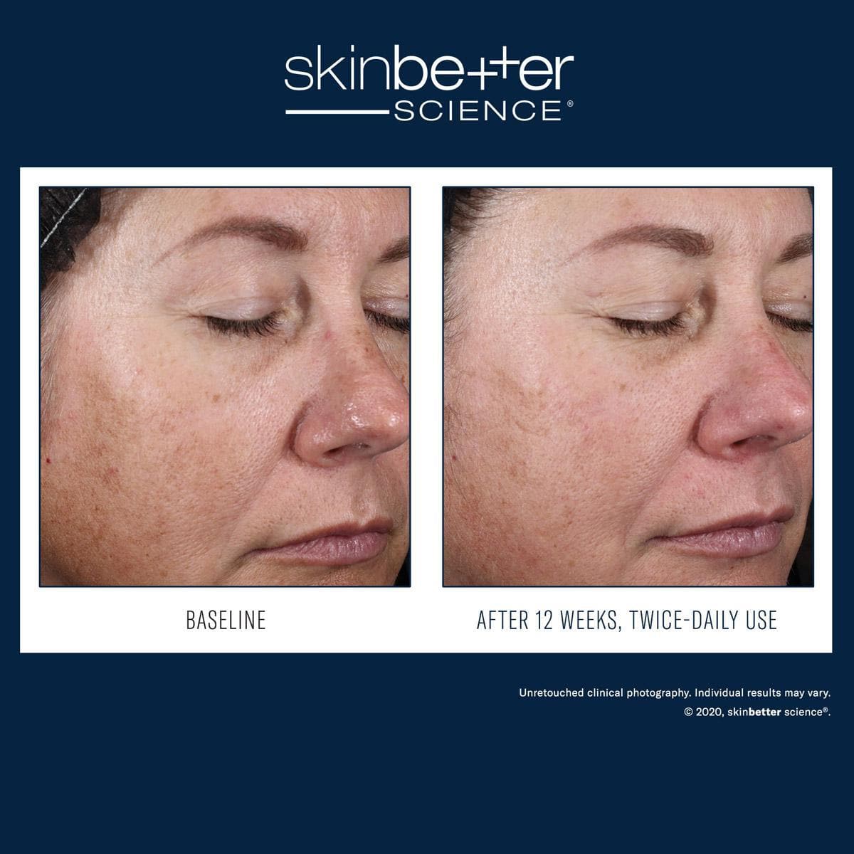 Skinbetter Science - Alto Advanced Defense and Repair by Monarch MD Medical Aesthetics