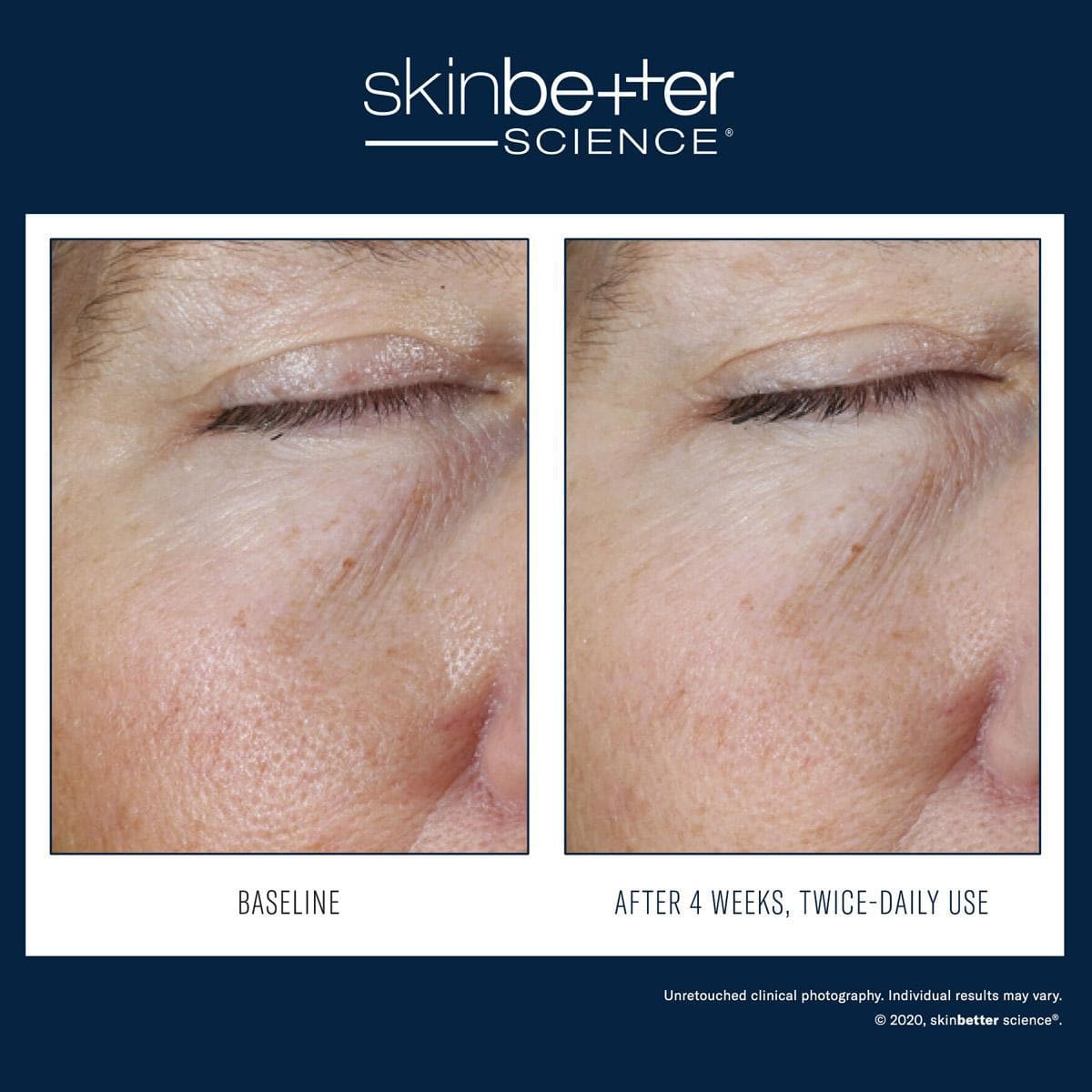 Skinbetter Science - Instant Effect Eye Gel by Monarch MD Medical Aesthetics