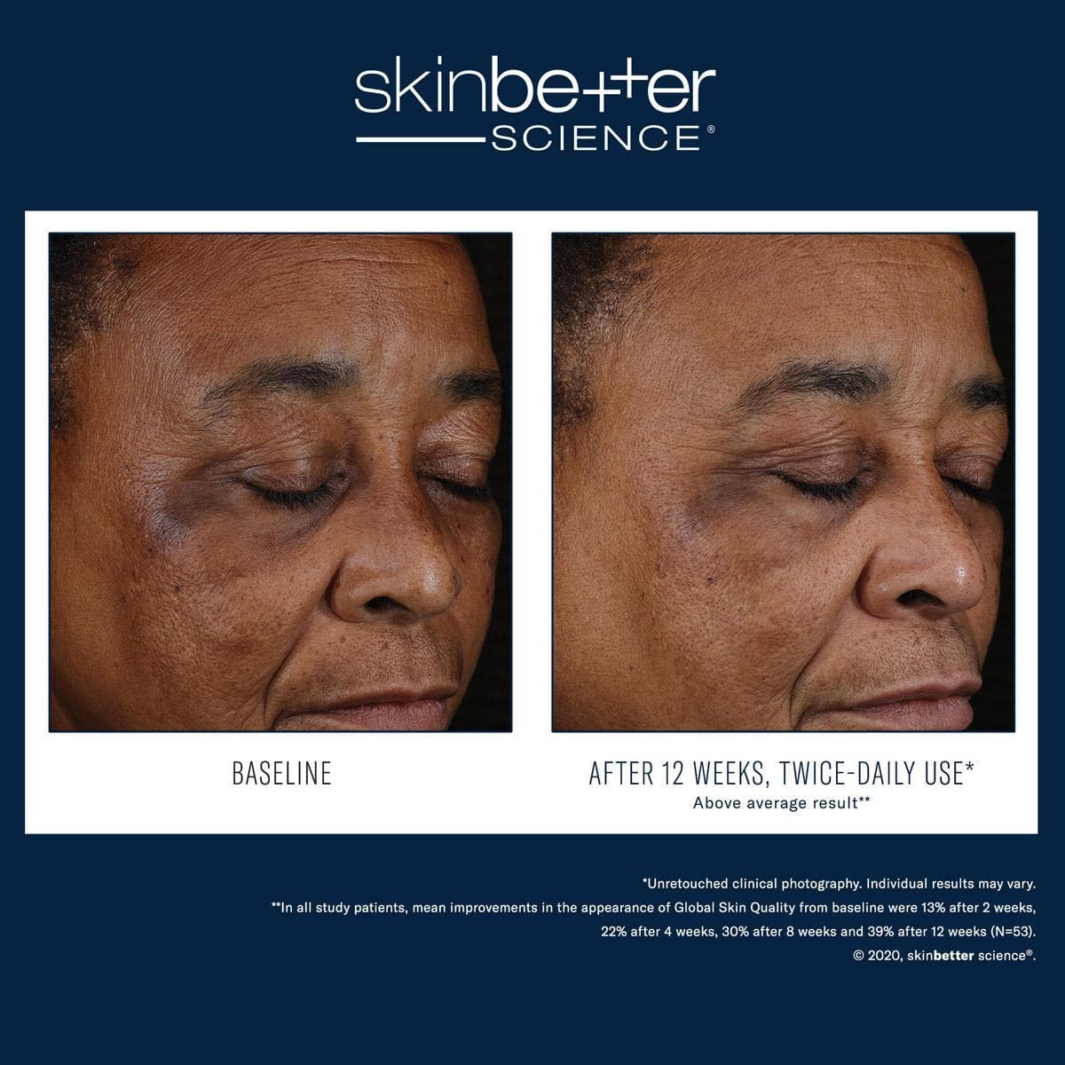 Skinbetter Science - Mystro Active Balance Serum by Monarch MD Medical Aesthetics