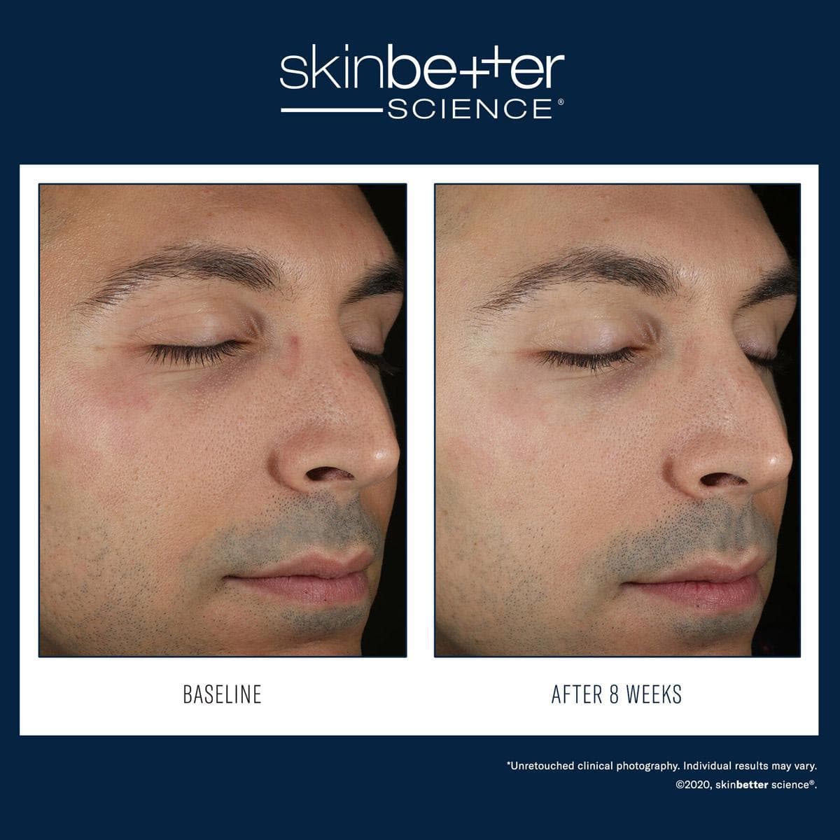 Skinbetter Science - Solo Hydrating Defense by Monarch MD Medical Aesthetics
