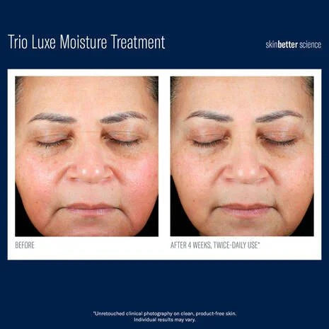 SkinBetter Science - Trio Luxe Moisture Treatment by Monarch MD Medical Aesthetics