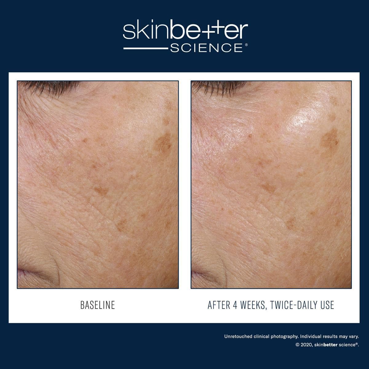 Skinbetter Science - Trio Rebalancing Moisture Treatment by Monarch MD Medical Aesthetics