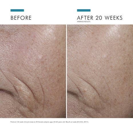 SkinCeuticals CE Ferulic by Monarch MD Medical Aesthetics
