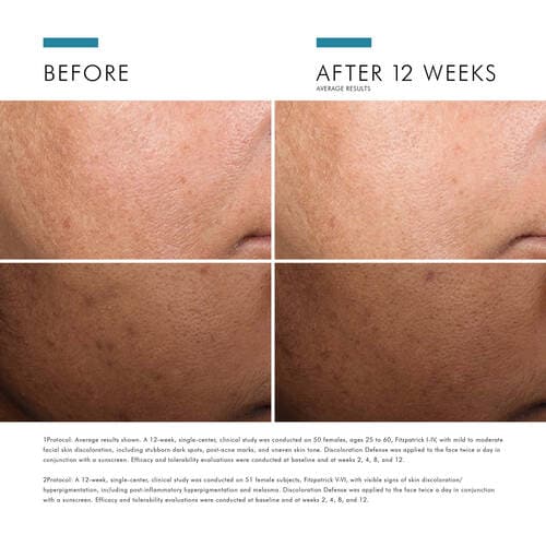 SkinCeuticals Discoloration Defense by Monarch MD Medical Aesthetics