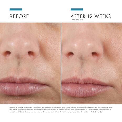 SkinCeuticals H.A. Intensifier by Monarch MD Medical Aesthetics