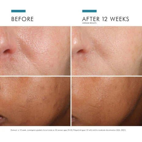 SkinCeuticals Phloretin CF by Monarch MD Medical Aesthetics