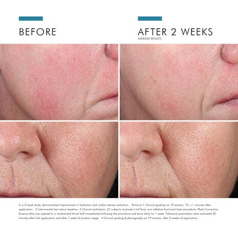 SkinCeuticals Phyto Corrective Essence Mist by Monarch MD Medical Aesthetics