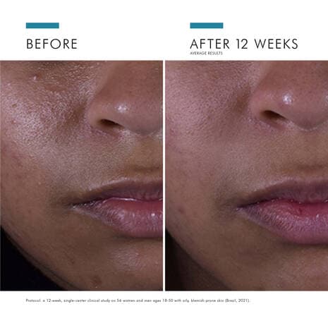 SkinCeuticals Silymarin CF by Monarch MD Medical Aesthetics