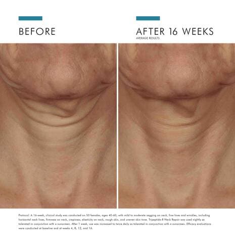 SkinCeuticals Tripeptide-R Neck Repair by Monarch MD Medical Aesthetics