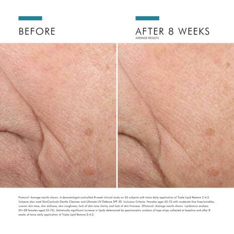 SkinCeuticals Triple Lipid Restore 2:4:2 by Monarch MD Medical Aesthetics