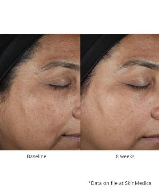 SkinMedica Lumivive™ System Day+Night by Monarch MD Medical Aesthetics