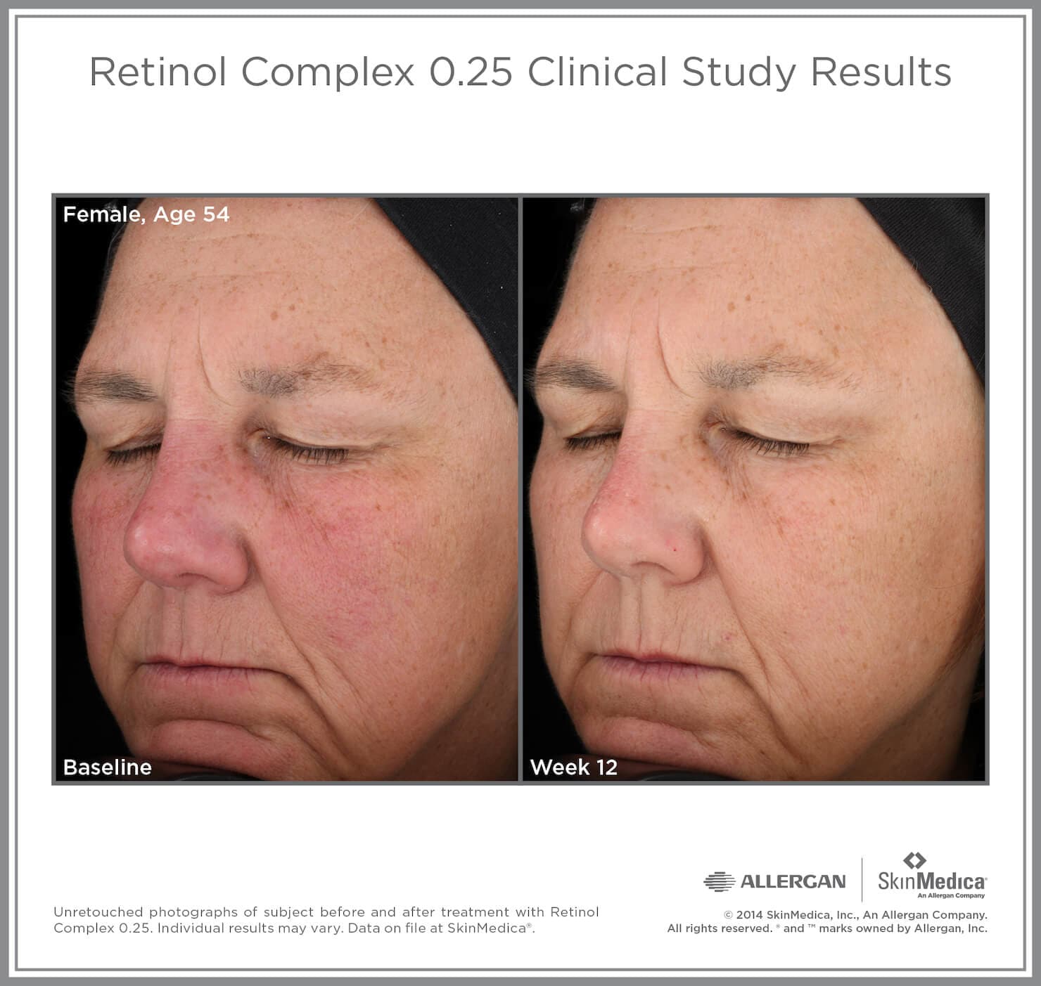 SkinMedica Retinol Complex by Monarch MD Medical Aesthetics
