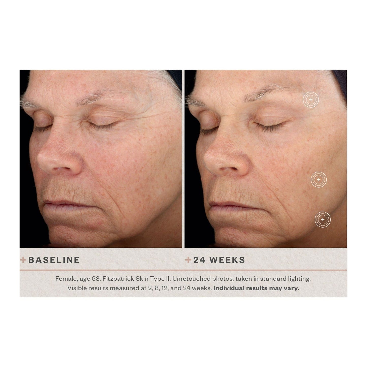 SkinMedica TNS Advanced+ Serum by Monarch MD Medical Aesthetics