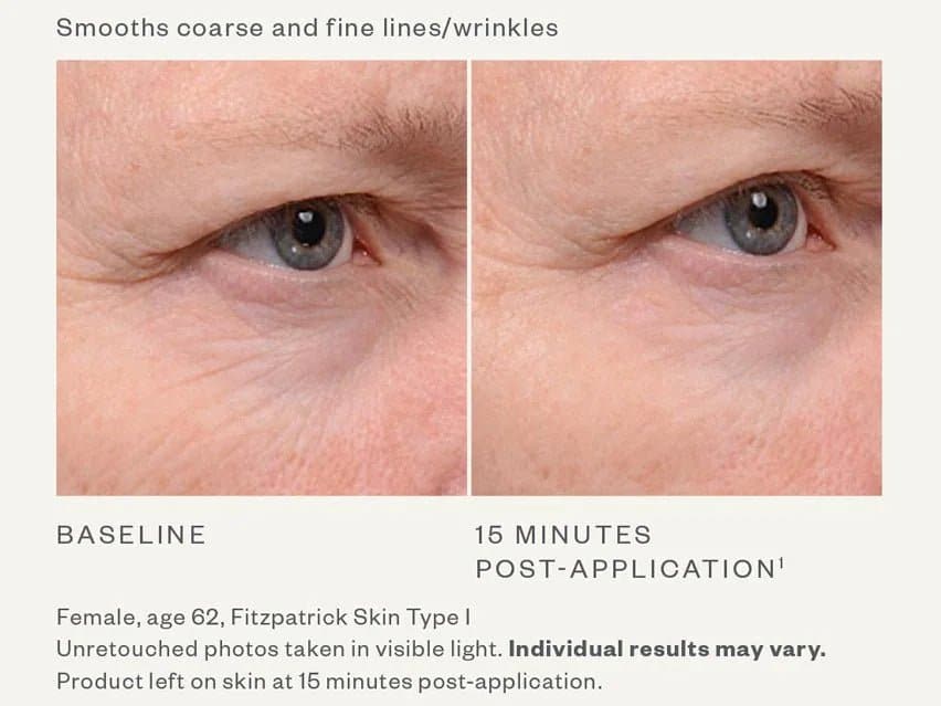 SkinMedica TNS Eye Repair by Monarch MD Medical Aesthetics