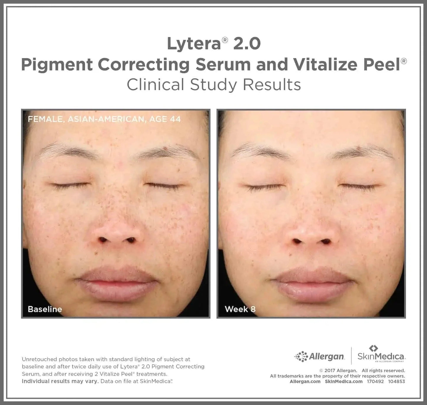 SkinMedica®Lytera 2.0 by Monarch MD Medical Aesthetics