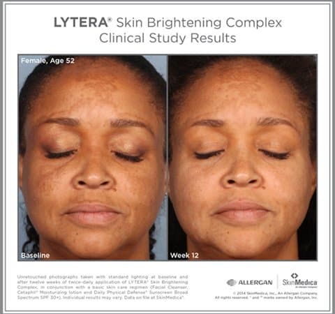 SkinMedica®Lytera 2.0 by Monarch MD Medical Aesthetics