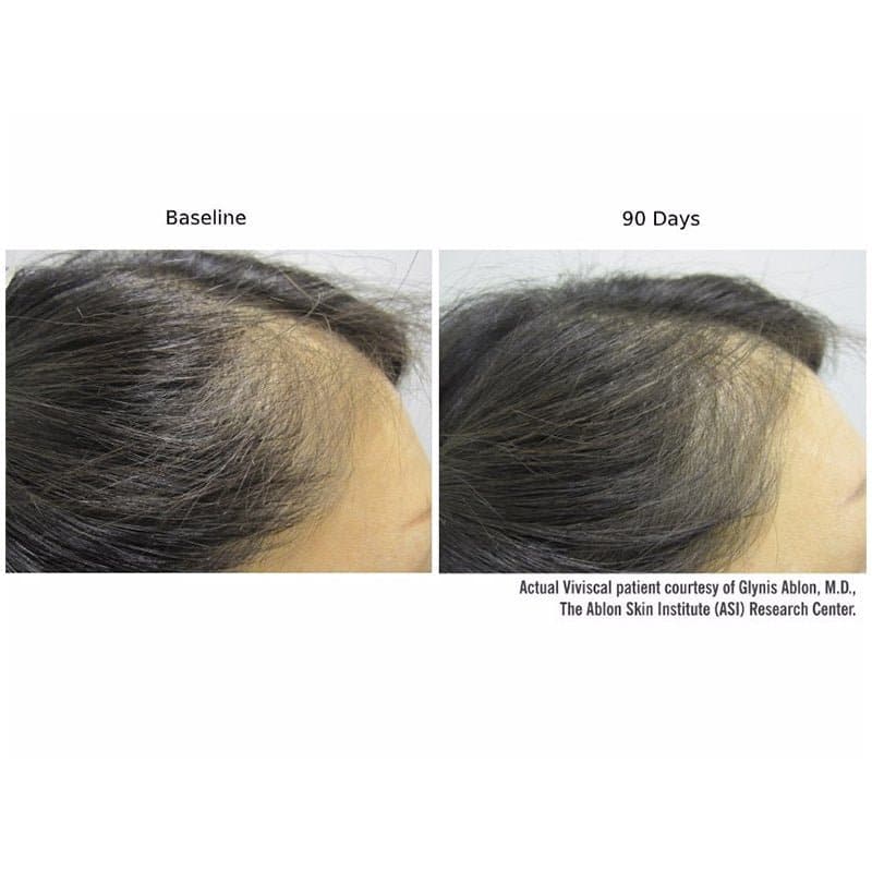 Viviscal Professional Vitamins by Monarch MD Medical Aesthetics