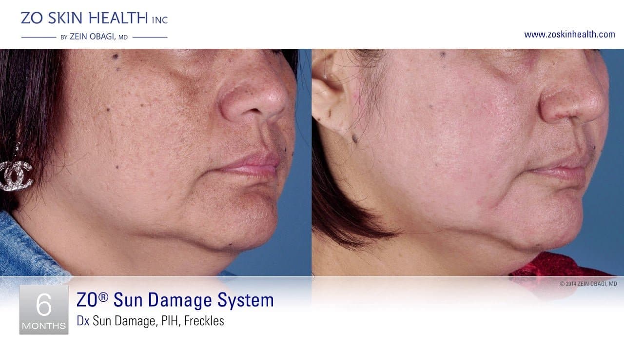 ZO Firming Serum by Monarch MD Medical Aesthetics
