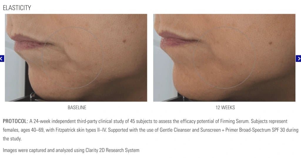 ZO Firming Serum by Monarch MD Medical Aesthetics