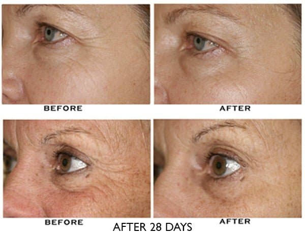 ZO Growth Factor Serum Eye by Monarch MD Medical Aesthetics