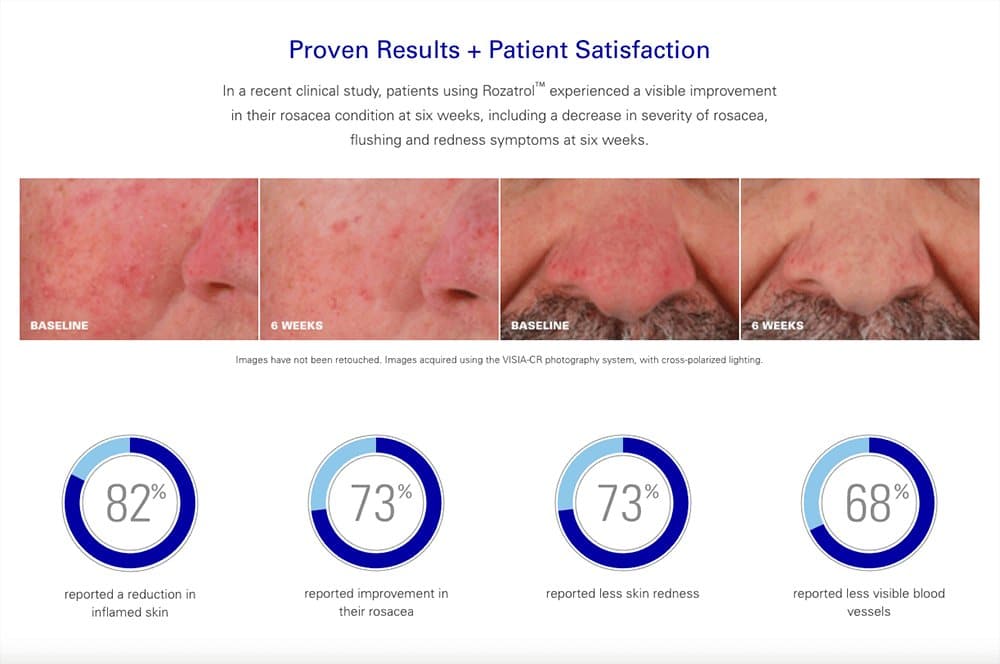 ZO Rozatrol by Monarch MD Medical Aesthetics